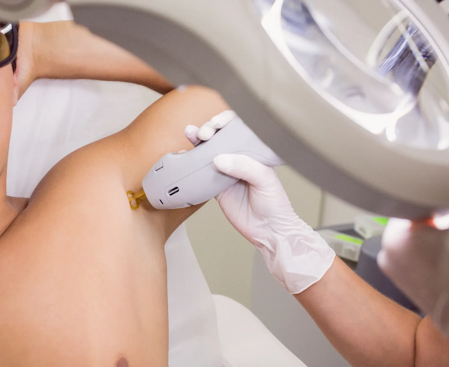 Laserhaarentfernung f&uuml;r Herren &ndash; effizient statt t&auml;glichem Rasieren